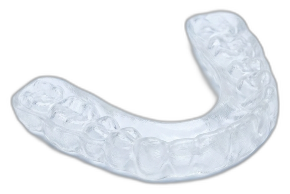 3D-printed occlusal splint