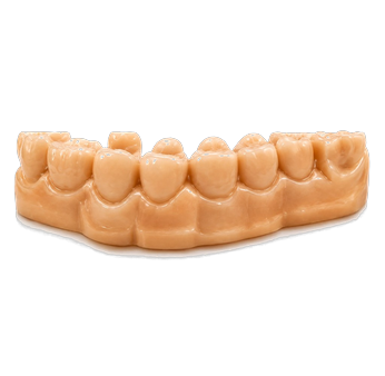 Tan temporary arch restoration